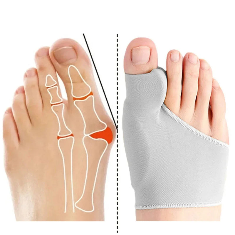Corretor de Joanete Silicone Ortopédico